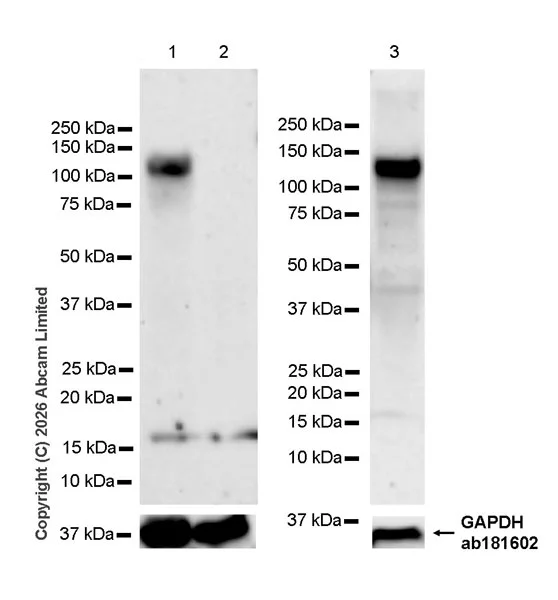 Western blot - Anti-TRAK1 antibody [EPR30574-567] (AB327353)