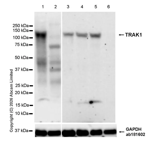 Western blot - Anti-TRAK1 antibody [EPR30574-567] (AB327353)