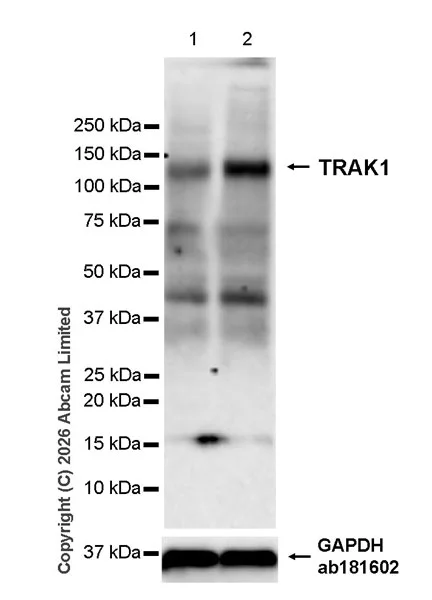 Western blot - Anti-TRAK1 antibody [EPR30574-567] (AB327353)