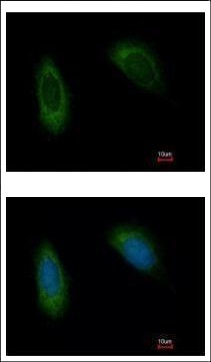Immunocytochemistry/ Immunofluorescence - Anti-TRAM1/TRAM antibody (AB96106), expandable thumbnail