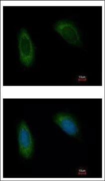 Immunocytochemistry/ Immunofluorescence - Anti-TRAM1/TRAM antibody (AB96106)