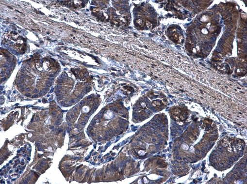 Immunohistochemistry (Formalin/PFA-fixed paraffin-embedded sections) - Anti-TRAM1/TRAM antibody (AB96106), expandable thumbnail