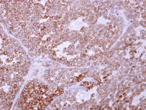 Immunohistochemistry (Formalin/PFA-fixed paraffin-embedded sections) - Anti-TRAM1/TRAM antibody (AB96106), expandable thumbnail