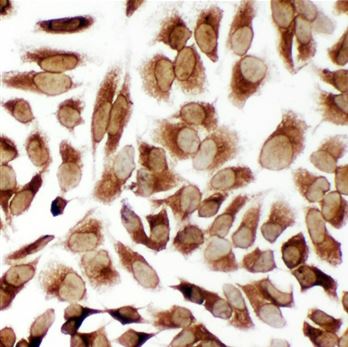 Immunocytochemistry - Anti-TRAM1/TRAM antibody - C-terminal (AB190982)