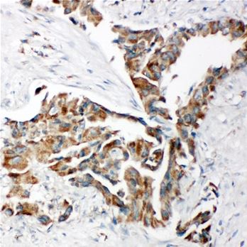 Immunohistochemistry (Formalin/PFA-fixed paraffin-embedded sections) - Anti-TRAM1/TRAM antibody - C-terminal (AB190982)