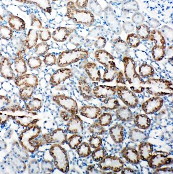 Immunohistochemistry (Formalin/PFA-fixed paraffin-embedded sections) - Anti-TRAM1/TRAM antibody - C-terminal (AB190982)