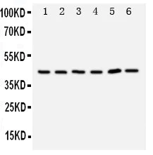Western blot - Anti-TRAM1/TRAM antibody - C-terminal (AB190982)