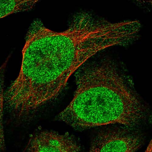 Immunocytochemistry/ Immunofluorescence - Anti-TRANK1 antibody (AB122283)