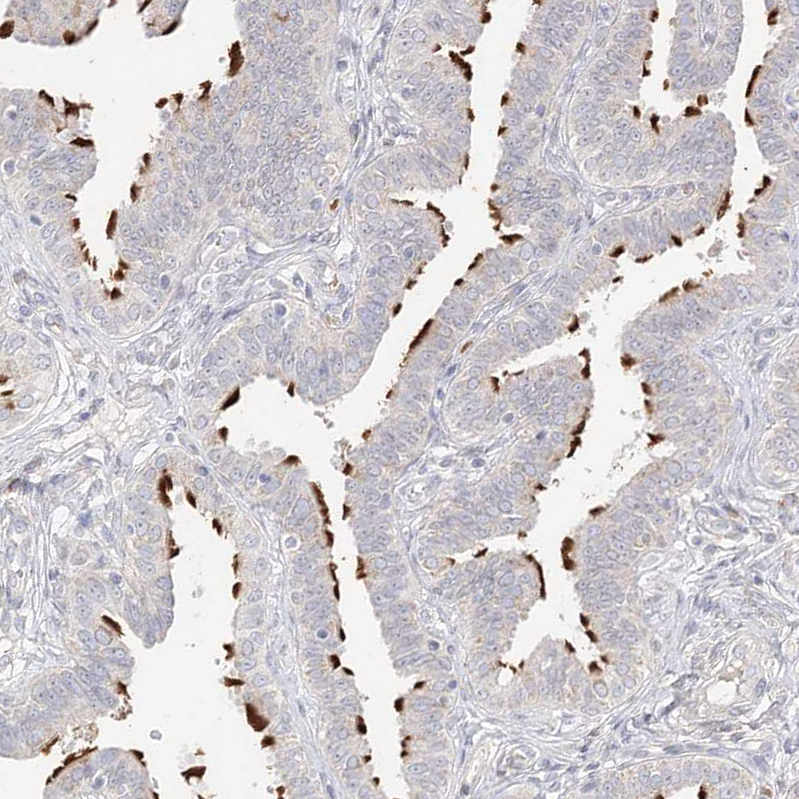Immunohistochemistry (Formalin/PFA-fixed paraffin-embedded sections) - Anti-TRANK1 antibody (AB122283)