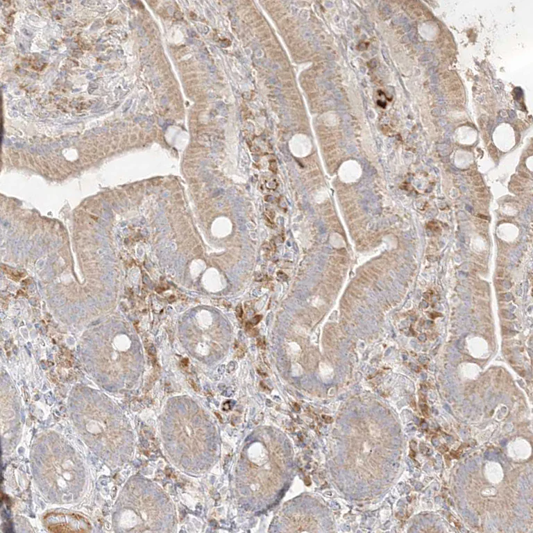 Immunohistochemistry (Formalin/PFA-fixed paraffin-embedded sections) - Anti-TRANK1 antibody (AB122283)