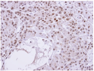 Immunohistochemistry (Formalin/PFA-fixed paraffin-embedded sections) - Anti-Transaldolase 1 antibody (AB137629), expandable thumbnail