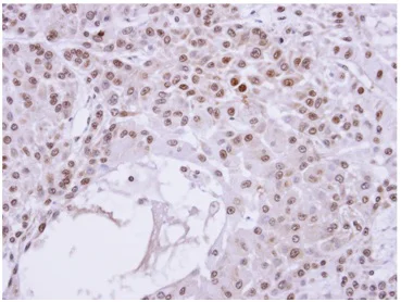 Immunohistochemistry (Formalin/PFA-fixed paraffin-embedded sections) - Anti-Transaldolase 1 antibody (AB137629)