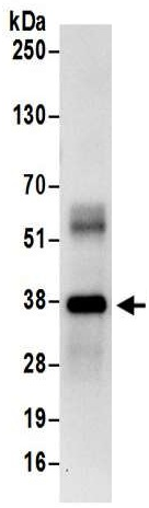Immunoprecipitation - Anti-Transaldolase 1 antibody (AB187689)