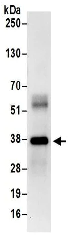 Immunoprecipitation - Anti-Transaldolase 1 antibody (AB187689)