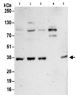 Western blot - Anti-Transaldolase 1 antibody (AB187689)