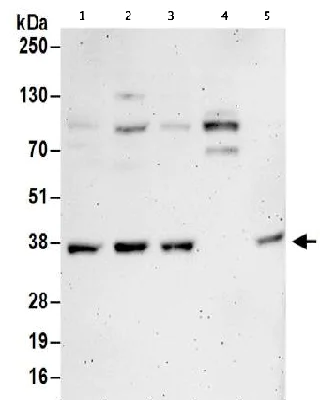 Western blot - Anti-Transaldolase 1 antibody (AB187689)
