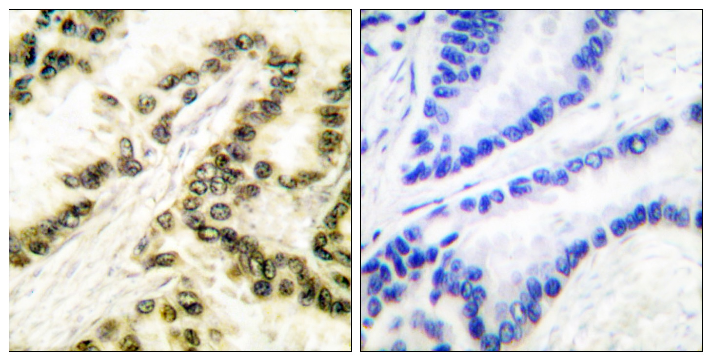 Immunohistochemistry (Formalin/PFA-fixed paraffin-embedded sections) - Anti-Transcription factor AP-2-alpha antibody (AB52222)