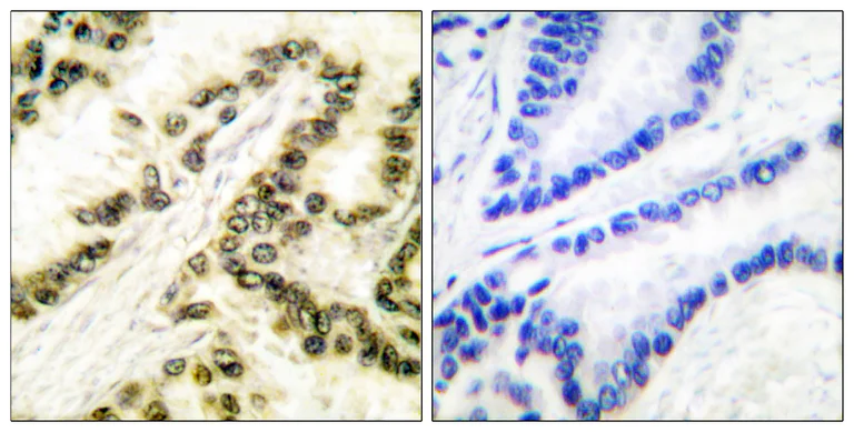 Immunohistochemistry (Formalin/PFA-fixed paraffin-embedded sections) - Anti-Transcription factor AP-2-alpha antibody (AB52222)