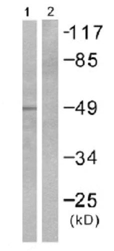 Western blot - Anti-Transcription factor AP-2-alpha antibody (AB52222)