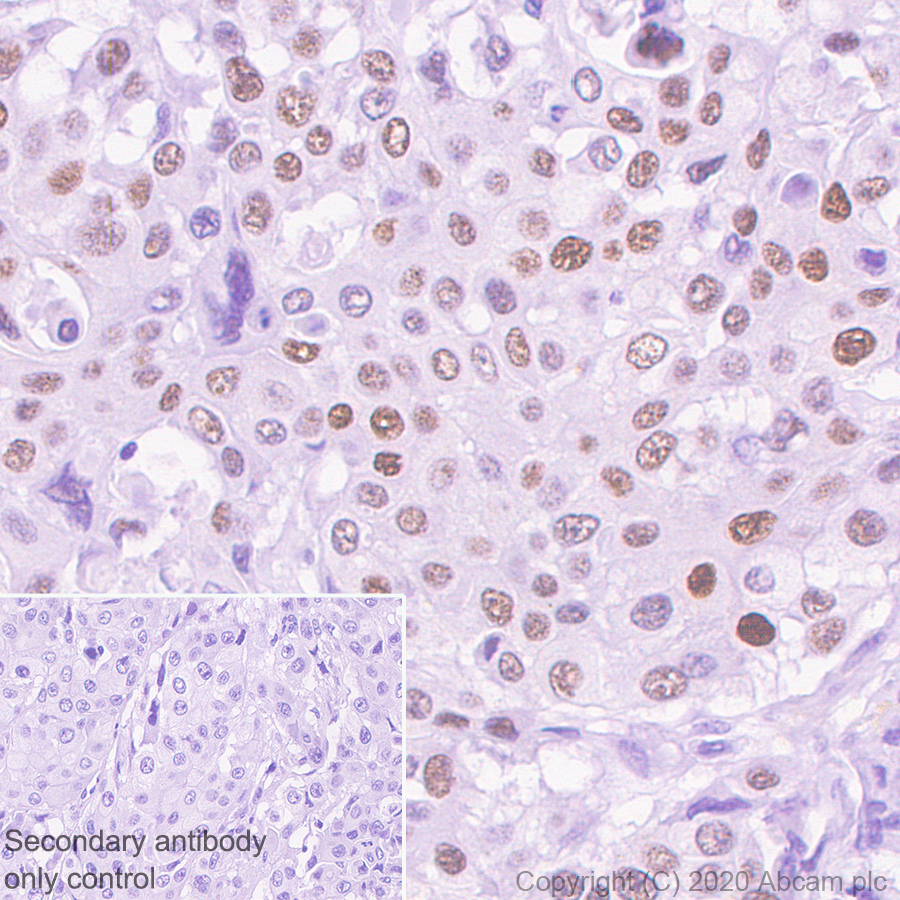 Immunohistochemistry (Formalin/PFA-fixed paraffin-embedded sections) - Anti-Transcription factor AP-2-alpha antibody [EPR2688(2)] (ab108311), expandable thumbnail