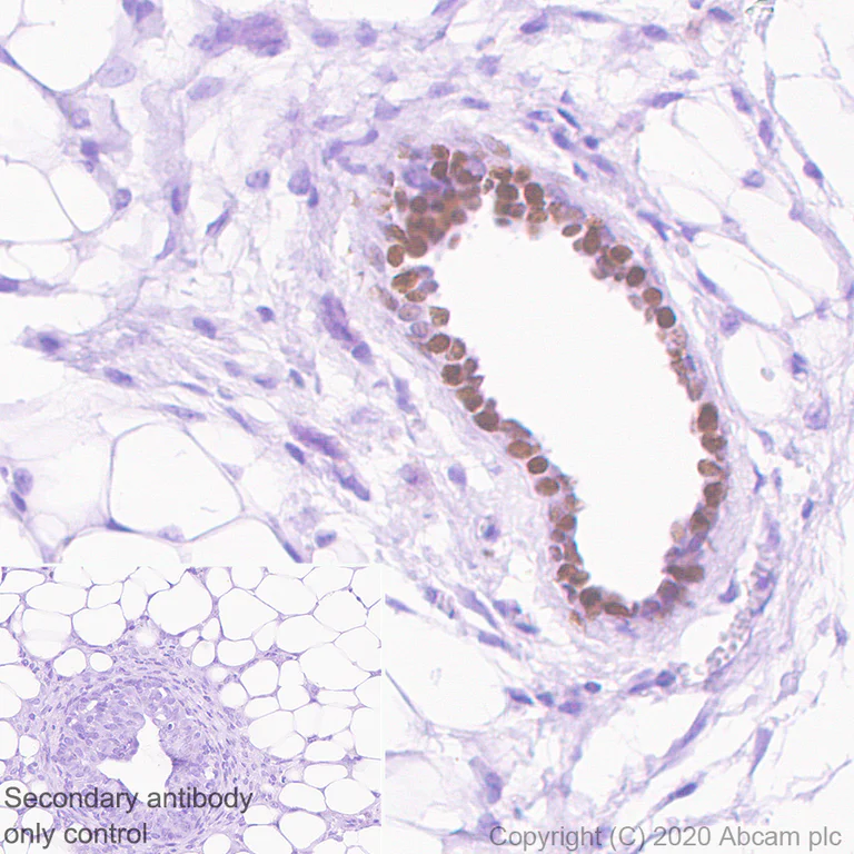 Immunohistochemistry (Formalin/PFA-fixed paraffin-embedded sections) - Anti-Transcription factor AP-2-alpha antibody [EPR2688(2)] - BSA and Azide free (AB236043)