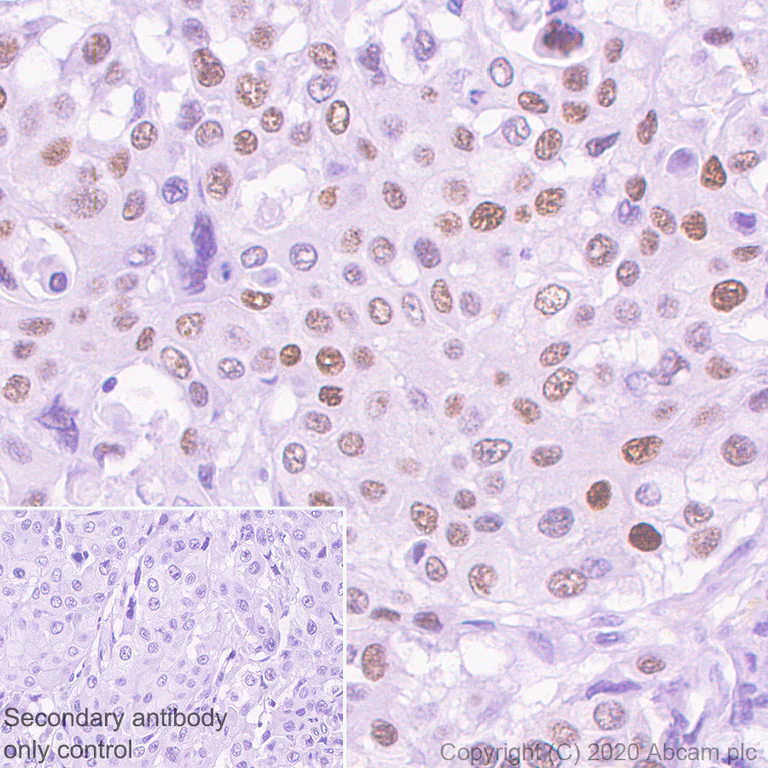Immunohistochemistry (Formalin/PFA-fixed paraffin-embedded sections) - Anti-Transcription factor AP-2-alpha antibody [EPR2688(2)] - BSA and Azide free (AB236043)