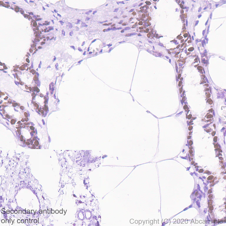 Immunohistochemistry (Formalin/PFA-fixed paraffin-embedded sections) - Anti-Transcription factor AP-2-alpha antibody [EPR2688(2)] - BSA and Azide free (AB236043)