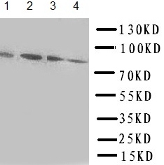 Western blot - Anti-Transcription factor Sp4 antibody (AB151777), expandable thumbnail