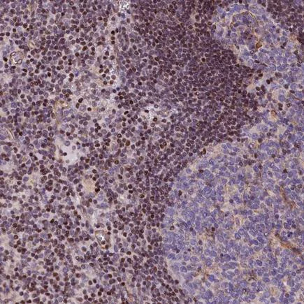 Immunohistochemistry (Formalin/PFA-fixed paraffin-embedded sections) - Anti-Transcription factor Sp4 antibody (AB243452)