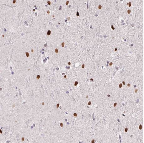 Immunohistochemistry (Formalin/PFA-fixed paraffin-embedded sections) - Anti-Transcription Factor SP9 antibody (AB204499)