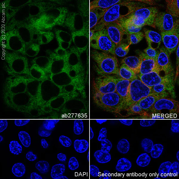 Immunocytochemistry/ Immunofluorescence - Anti-Transferrin antibody [EPR20149-224] - BSA and Azide free (AB277640)