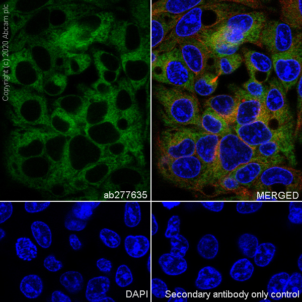 Immunocytochemistry/ Immunofluorescence - Anti-Transferrin antibody [EPR20149-224] (ab277635), expandable thumbnail