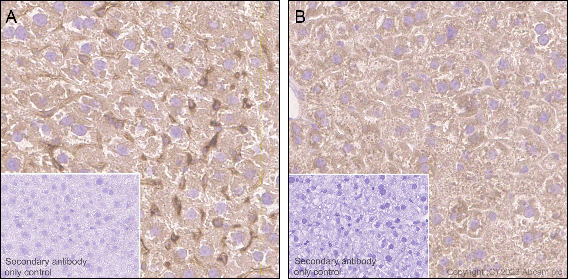 Immunohistochemistry (Formalin/PFA-fixed paraffin-embedded sections) - Anti-Transferrin antibody [EPR28141-177] (AB313583), expandable thumbnail