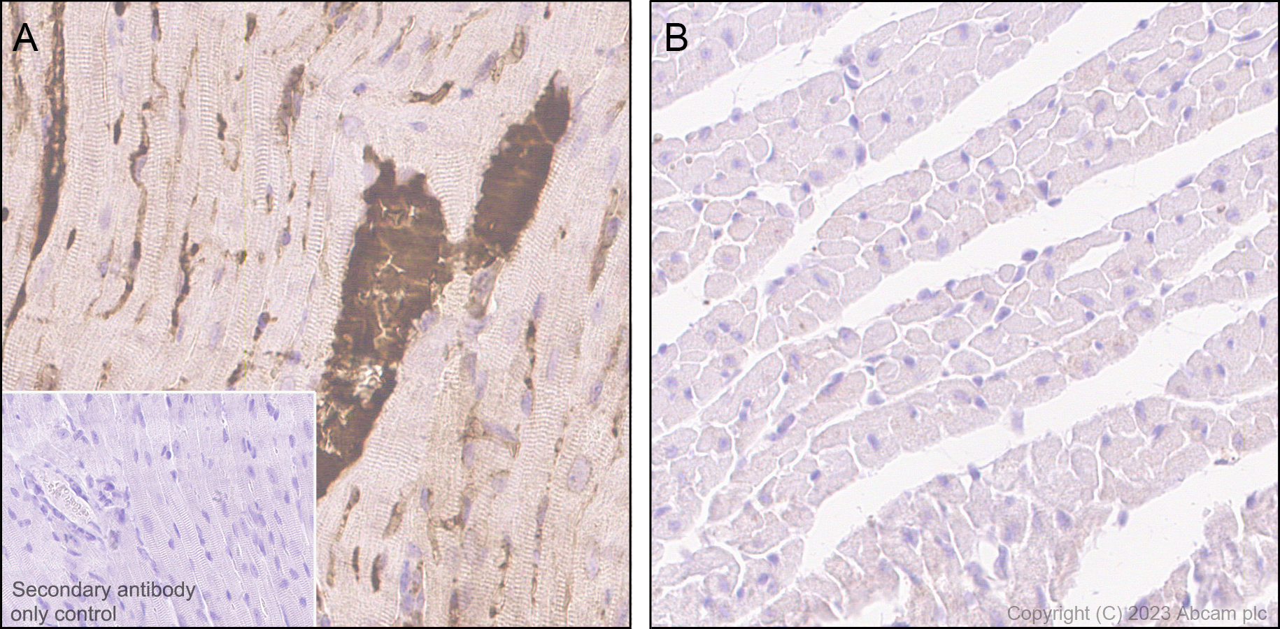 Immunohistochemistry (Formalin/PFA-fixed paraffin-embedded sections) - Anti-Transferrin antibody [EPR28141-177] (AB313583), expandable thumbnail