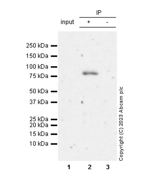 Immunoprecipitation - Anti-Transferrin antibody [EPR28141-177] (AB313583), expandable thumbnail