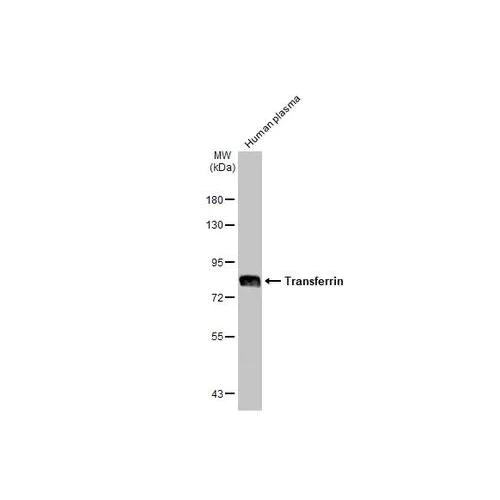 Western blot - Anti-Transferrin antibody [HL2429] (AB317223)