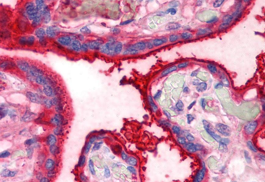 Immunohistochemistry (Formalin/PFA-fixed paraffin-embedded sections) - Anti-Transferrin antibody [HTF-14] (AB769), expandable thumbnail