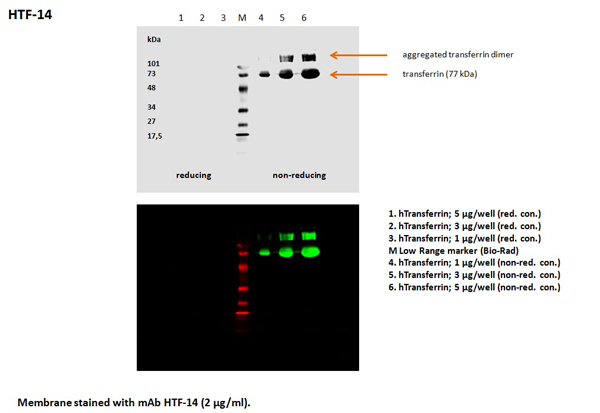 Western blot - Anti-Transferrin antibody [HTF-14] - Serum Loading Control (AB769), expandable thumbnail