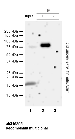 Immunoprecipitation - Anti-Transferrin antibody [RM1092] - BSA and Azide free (ab316296), expandable thumbnail
