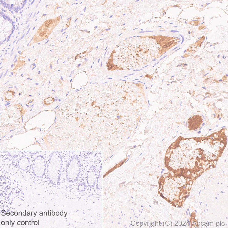 Immunohistochemistry (Formalin/PFA-fixed paraffin-embedded sections) - Anti-Transferrin antibody [RM2060] (ab318997), expandable thumbnail