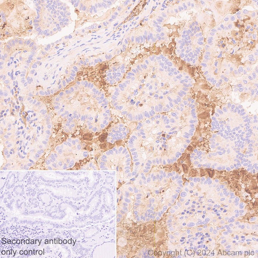 Immunohistochemistry (Formalin/PFA-fixed paraffin-embedded sections) - Anti-Transferrin antibody [RM2060] (ab318997), expandable thumbnail