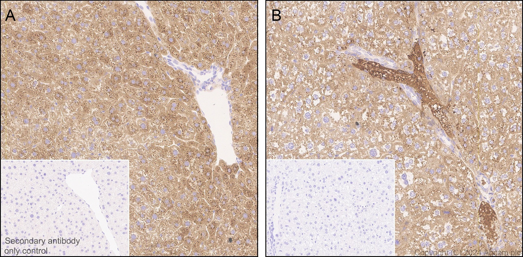 Immunohistochemistry (Formalin/PFA-fixed paraffin-embedded sections) - Anti-Transferrin antibody [RM2060] (ab318997), expandable thumbnail