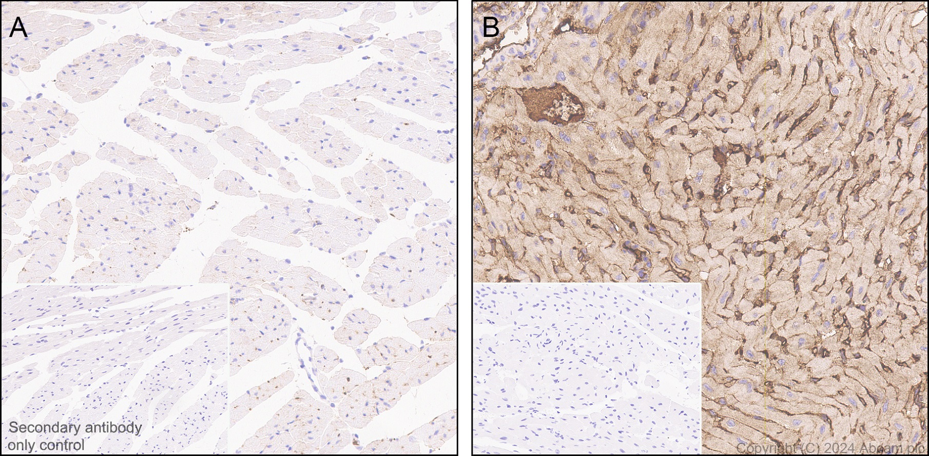 Immunohistochemistry (Formalin/PFA-fixed paraffin-embedded sections) - Anti-Transferrin antibody [RM2060] (ab318997), expandable thumbnail