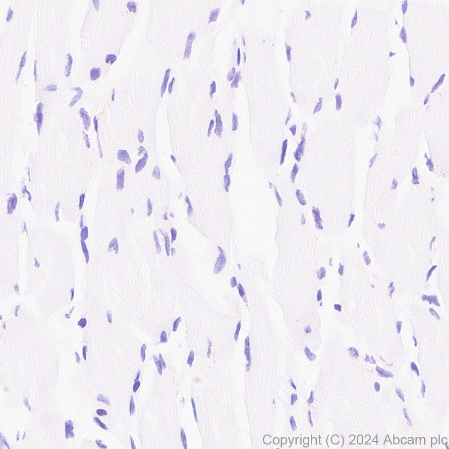 Immunohistochemistry (Formalin/PFA-fixed paraffin-embedded sections) - Anti-Transferrin antibody [RM2060] (AB318997), expandable thumbnail