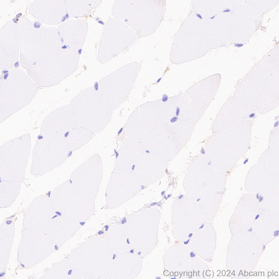 Immunohistochemistry (Formalin/PFA-fixed paraffin-embedded sections) - Anti-Transferrin antibody [RM2060] (ab318997), expandable thumbnail