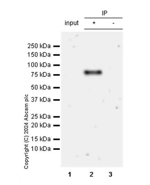 Immunoprecipitation - Anti-Transferrin antibody [RM2060] (AB318997), expandable thumbnail