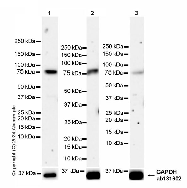 Western blot - Anti-Transferrin antibody [RM2060] (ab318997), expandable thumbnail