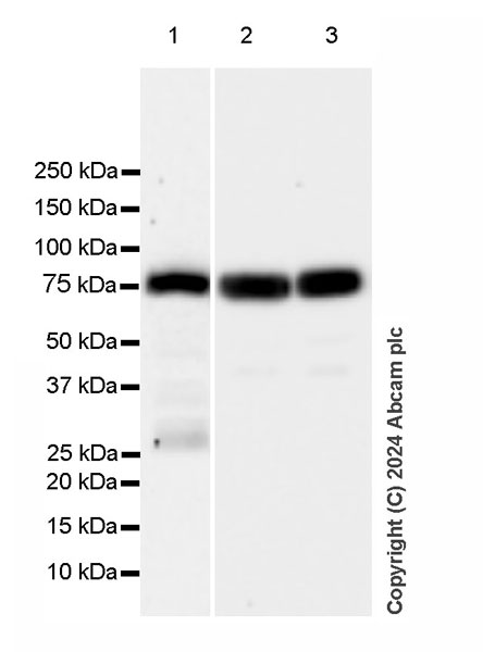 Western blot - Anti-Transferrin antibody [RM2060] (ab318997), expandable thumbnail