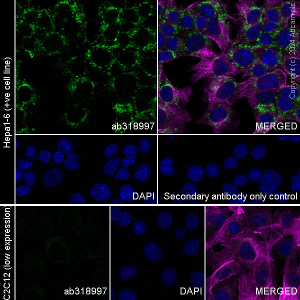 Immunocytochemistry/ Immunofluorescence - Anti-Transferrin antibody [RM2060] - BSA and Azide free (AB318998)