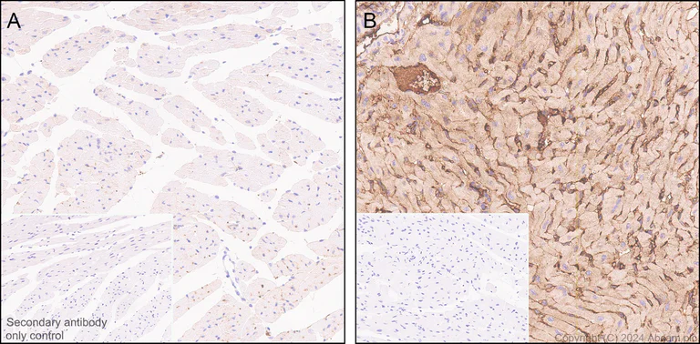 Immunohistochemistry (Formalin/PFA-fixed paraffin-embedded sections) - Anti-Transferrin antibody [RM2060] - BSA and Azide free (AB318998)